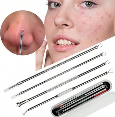 Waledano® Comedonenlepel Set van 4 - Mee eter lepel met een handig opbergdoosje - Mee-eters verwijderen - Blackhead remover - Acne Verwijderen Set
