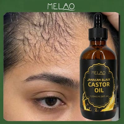 MELAO Batana Olie 118ml, Voedende Haarkeuze, Natuurlijke Plant-geïnfuseerde Haarzorgolie, Hydraterende Haarextract, Geschikt Voor Droog En Pluizig Haar