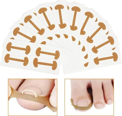 Teennagelcorrectie stickers, 40 stuks per verpakking, ingegroeide teennagel stickers, pedicure stickers, elastische teennagel stickers