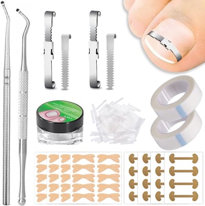 Dailygoods- Ingegroeide Teennagelset 212-delig - Nagelcorrectie - Nagelknippers - Plakband - Correctiepleisters - Voetverzorging - Teennagelcorrectie