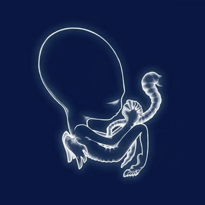 Agaetis Byrjun - Sigur Ros