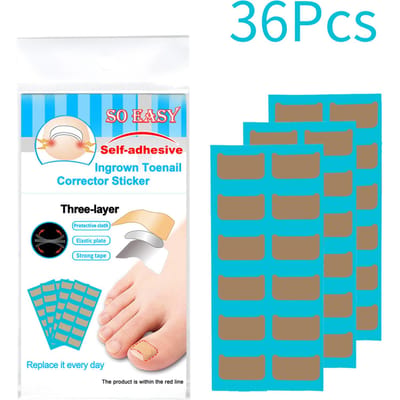 Ingegroeide nagelcorrectiekit Ingegroeide teennagelstickers Rechttrekkende behandeling Herstellen Correctorteen 36pcs
