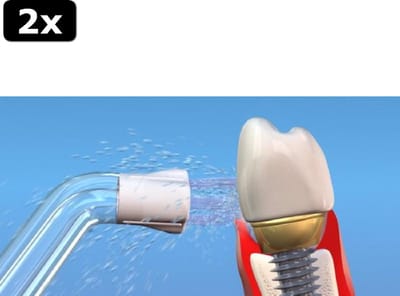 2x Waterpik PS-100E Plaque Seeker Tips - Opzetstukken Voor Waterflossers - 2 Stuks - zilver