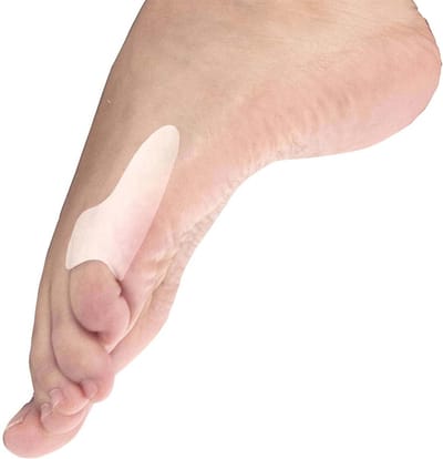 Mövibrace - Kleine Teen Beschermer - Teenbeschermer - Zijkant Voet - Tegen Druk En Wrijving - Gel - Unisex