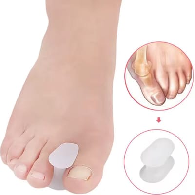 Jonyx - Teenspreider - Teencorrector - Hallux Valgus - Teenpijn - Siliconen - 2 stuks