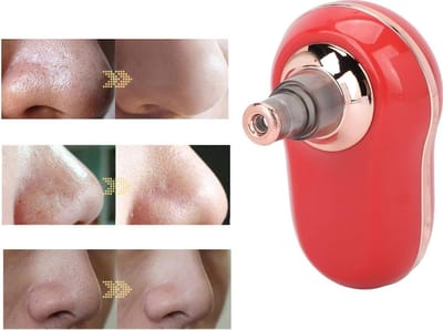 Elektrische Black Head remover - Mee eters - Mee eters verwijderen - Elektrisch - Oplaadbaar - Huidverzorging