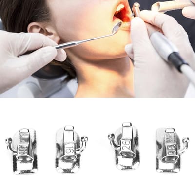 2 Pakketten Tandheelkundige Orthodontische Bondbare Buccale Buis Tandverzorgingsgereedschap Medische Apparatuur Edgewise Eerste Molaar