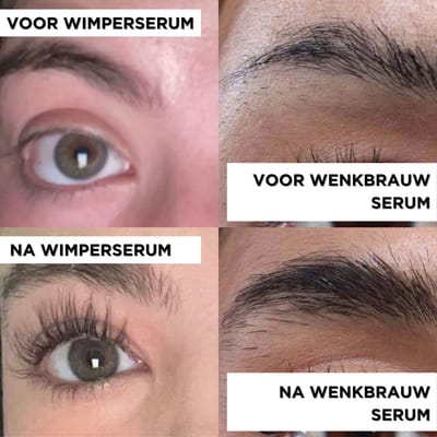 NATURA LASHES & NATURA BROWS Wimperserum en Wenkbrauwserum Bundel – 2 stuks – Lash Serum & Wenkbrauw Serum – Lash Growth & Wenkbrauw Groei – Lashlift – Langere Wimpers & Dikkere Wenkbrauwen – Geen Prostaglandinen