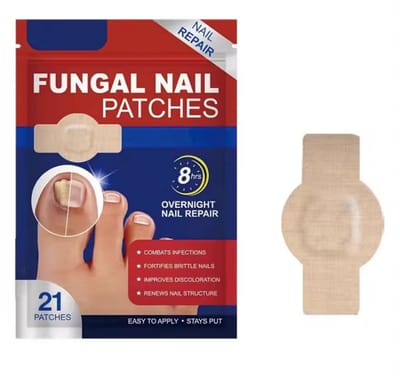 21-Stuks Waterdichte Teennagel Schimmel Patches – Nagelherstel & Correctie voor Ingegroeide, Verkleurde en Beschadigde Nagels – Voetverzorging Behandeling- Beige