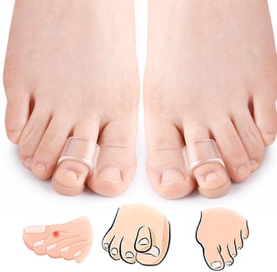 Siliconen Teenspreiders Transparant (1 Paar) – Teenscheider 2025 – Toe Sleeves – Voor 3 Middelste Tenen – Hamertenen Corrector – Teenoverlap & Pijnverlichting – Voor Mannen & Vrouwen