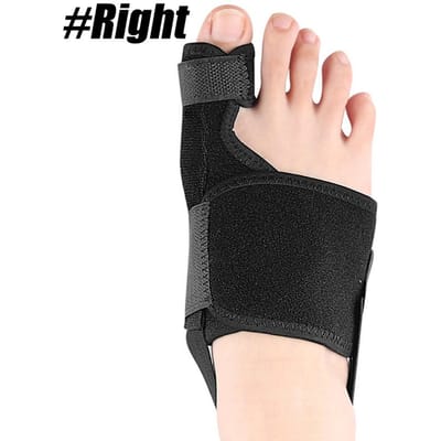 1/2 Stuks Hallux Valgus Corrector Orthopedische Spalk Teen Strekker Met Antislipband Dag Nacht Ondersteuning Voor Pijnverlichting beige