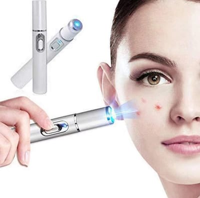 Blauw Licht Gezicht Laserpen - Acne & Rimpel Verwijdering - Face Acne Laser Pen - Gezicht - Huidverzorging - LOUZIR