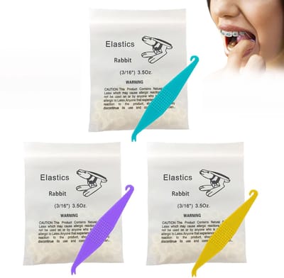 Dailygoods- Orthodontische Elastiekjes 300 Stuks - Multifunctionele Orthodontische Elastieken - Tandopening - Rubber - Lichtgewicht - Veilig en Niet Giftig - Beugelbandjes