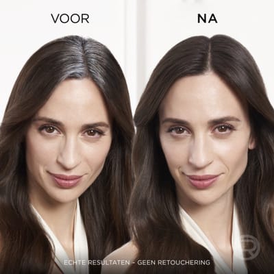 L'Oréal Magic Retouch Uitgroeispray Donkerblond - 3 x 75 ml - Voordeelverpakking