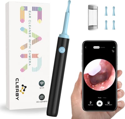 Oorsmeer Verwijderaar met Camera - Oorreiniger met App - Ear Cleaner - Oorlepel - Earscratcher voor Oor Schoonmaken - Wifi - Zwart