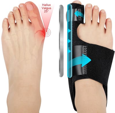 Bunion Corrector voor vrouwen en mannen, grote eeltknobbels corrector set met 2 x orthopedische eeltknobbels en 2 x grote teen stijltangen, verstelbare hallux valgus correctie voor dag/nacht