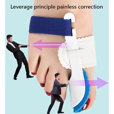 2 stuks Hallux Valgus Corrector voor Vrouwen Universele Vrouwelijke Teenspalken Teenspreiders voor Overlappende Grote Teen beige