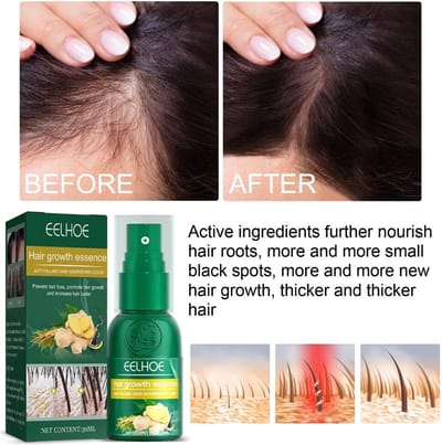 Gember Haargroei Serum - Duo Verpakking - Gember Haar Spray voor Haargoei - Vollere Bos Haren - Anti Kaalheid - Haar Wordt Dikker - Ginger Hairspray - Ga Dunner Wordend Haar Tegen - Betere Baardgroei