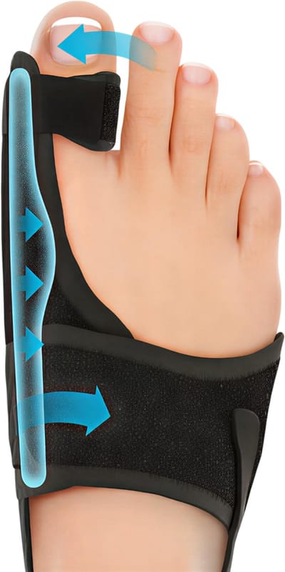 Orthopedische Hallux Valgus Corrector – Teen Separator & Bunion Spalk 1 Paar | Pijnverlichting, Niet-Chirurgische Correctie van Hamerteen en Scheve Teen