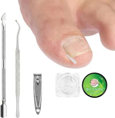Pijnloze set voor het corrigeren van ingegroeide teennagels met 50 gladmakende strips, nagelknipper en lifter voor optimale verzorging