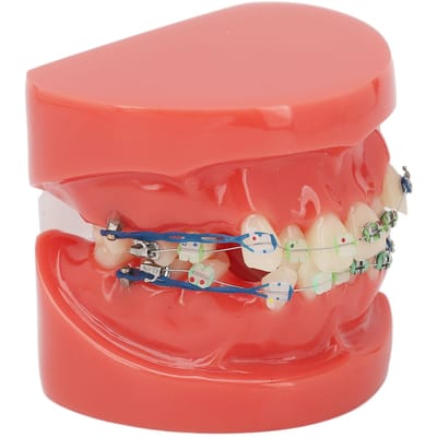 Dental Model Metalen Draden 24 Tanden Half Metaal Half Keramische Bracket Tand Correctiemodel voor Studie red