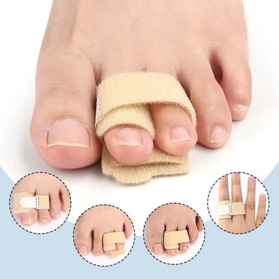 Teen Corrector voor Hallux Valgus – Verstelbare Bunion Spalk voor Scheve of Overlappende Tenen – Orthopedische Teenstand Correctie Brace