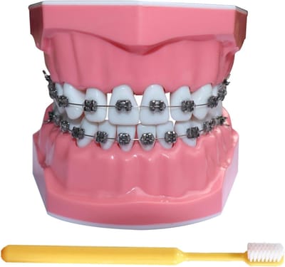 Tanden Model - Orthodontie Demonstratie - Tandheelkundig Onderwijs - Met Vaste Beugels - 9.4cm - Transparant