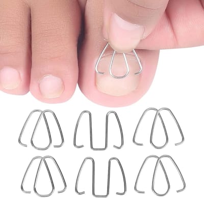 Correctiedraad voor Teennagels - Pedicurebehandeling voor Nagelherstel en Voetverzorging, Bunioncorrector voor Mannen en Vrouwen, Dikke Teennagels en Ingroeiende Nagels