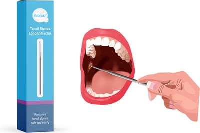 MiBrush amandelsteen verwijder tool - RVS - keelamandelstenen - 1 stuk