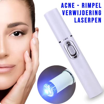 Allernieuwste.nl® Blauwe Licht Gezicht Laserpen - Acne & Rimpel Verwijdering + Huidverjonging ##