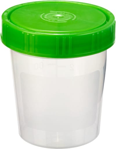 Urine Potjes – 10 Stuks - 100 ML – Afsluitbaar – Herbruikbare Containers