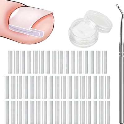 longziming - Ingegroeide Teennagel Corrector - Teennagel Beugel Set - Nagel Correctie Strips - Individueel Aanpasbare Pasvorm - Ultradun Kunststof - Hoge Flexibiliteit En Comfort - Dagelijks Gemakkelijk Zelf Toepassen - 50 Stuks