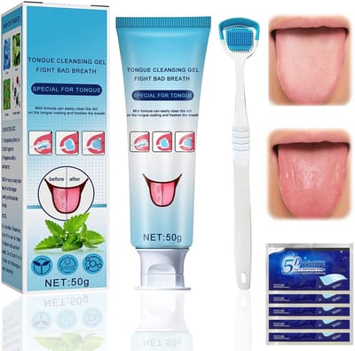 Dailygoods- Tongreinigingsset - Tongreiniger Gel (50 g) - Tongborstel - Tongschraper - Slechte Adem Bestrijding - Frisse Adem