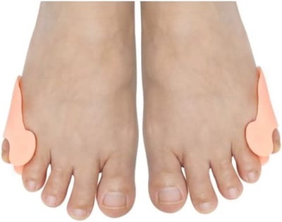 Go Go Gadget - Kleine teen spreider - Teencorrector - Likdoorn verwijderaar - Hallux Valgus - Teenspalk - Siliconen Teenspreiders - 1 set van 2 stuks - Beige