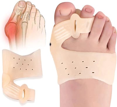 Knobbel Teen Corrector I Hallux Valgus Siliconen Teenbeschermers I Teenspreider I Teen Corrector I Bunion I Eeltknobbel | Teen Rechtzetten I 1 Paar I Beige