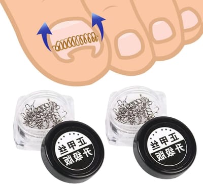 Ingrown Toenails Correctie Draad - RVS Nagelcorrector voor Pedicure en Nagelsalon, Effectieve Verzorging voor Ingroeiende Teennagels