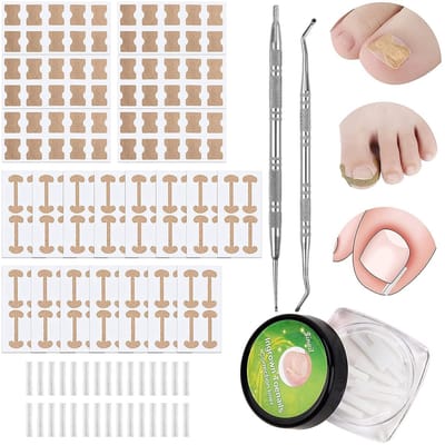 Dailygoods- Pedicureset 152 Stuks - Ingrowende Teennagelinstrumenten - Teennagelvijl - Teennagellifter - Nagelcorrectiestickers - Voetverzorging - Nagelverzorgingsset