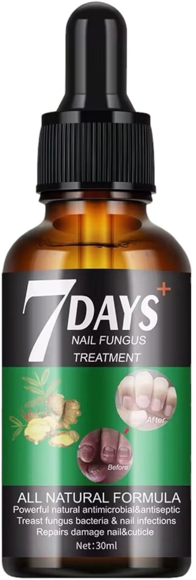 Nagelschimmel behandeling 30 ml - Kalknagelbehandeling - Nagelbehandeling - Nageldruppels - tegen Zwemmerseczeem -