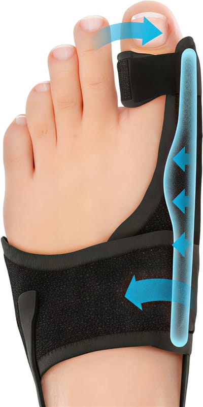 Orthopedische Hallux Valgus Corrector – Teen Separator & Bunion Spalk voor Linker Grote Teen | Pijnverlichting, Niet-Chirurgische Correctie van Hamerteen en Scheve Teen
