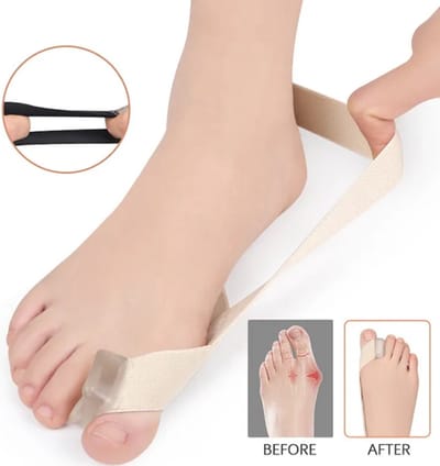 Hallux Valgus Teencorrector I Teenspreider I Elastische Spanningsband I Teen Recht Maken I 1 Stuk I Maat L I Maat 40-45