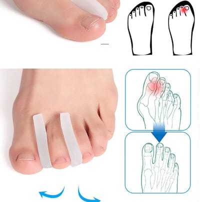 Jumada's - Siliconen Teencorrector I Teenspreiders I Gel I Hallux Valgus I Recht Maken I Toe Straigntner I 2 Stuks I Wit