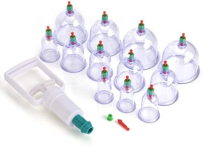 Traditionele Chinese Vacuum Cupping Massage - Acupunctuur Suction Cups voor Ontspanning en Pijnverlichting