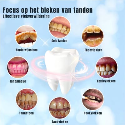 AMA® Tandsteen Verwijderaar - Tandplak Verwijderaar - Elektrische Tandsteen Verwijderaar - 20x4x20cm - Zwart