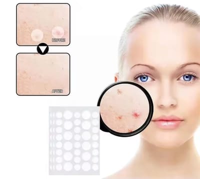 CHPN - Pimple Patch - Acne Patch - Puistensticker - Acne Sticker - Puisten Pleister - Pimple Patches - Acne Pleister - Puisten Verwijderaar - 36 stickers