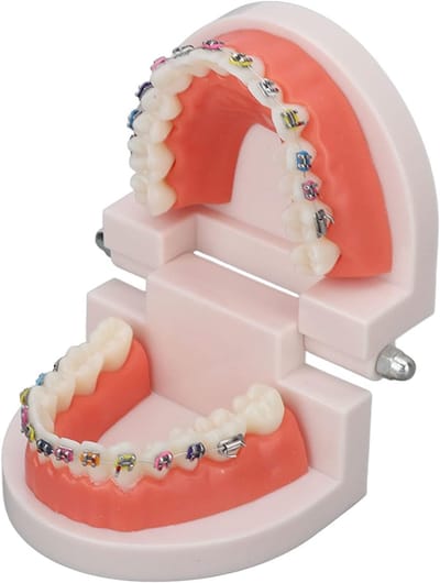 Tandheelkundige Demonstratie Model Typodont Met Orthodontische Metalen Beugel voor Tandarts Onderwijs en Onderzoek