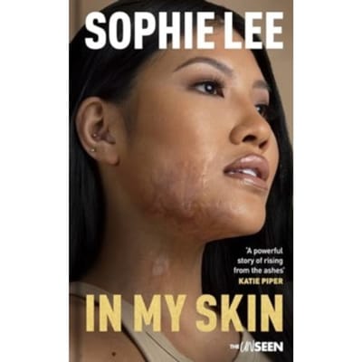 In My Skin - Katie Piper's The Unseen - Sophie Lee