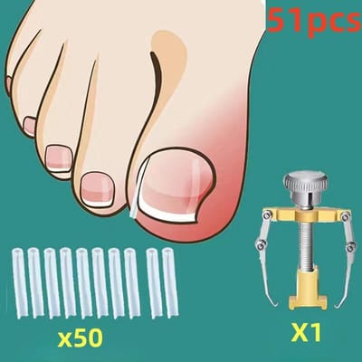 Een Set (51 stuks) Bevat 1 Corrector En 50 Spacers, een Soft-Touch Ingegroeide Teennagel Correctie Tool - Ontworpen voor Voorzichtig Knippen, Verzachten