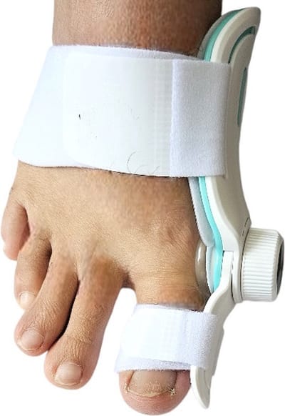 Teenbrace, teenseparators, teen spalk, teen corrector, Braces, Teen beugels, teen, hallux valgus corrector, hallux valgus, teen separator, Teen spreider, orthopedische teen brace, teen brace, voet brace, teen splint,bunion brace, toe, Teen corrector.