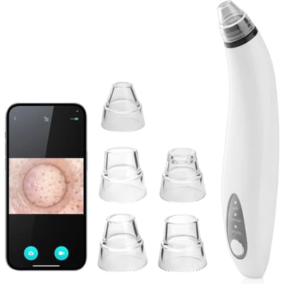 Aspirateur voor mee-eters met ingebouwde camera Paloma Beauties