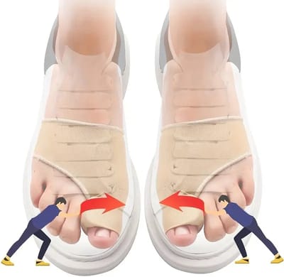 CHPN - Hallux Valgus - Tenen beschermen - Teencorrector - Knobbel - Corrigeer en zet je tenen recht met deze teenspreiders - 1 paar - Teenspreider
